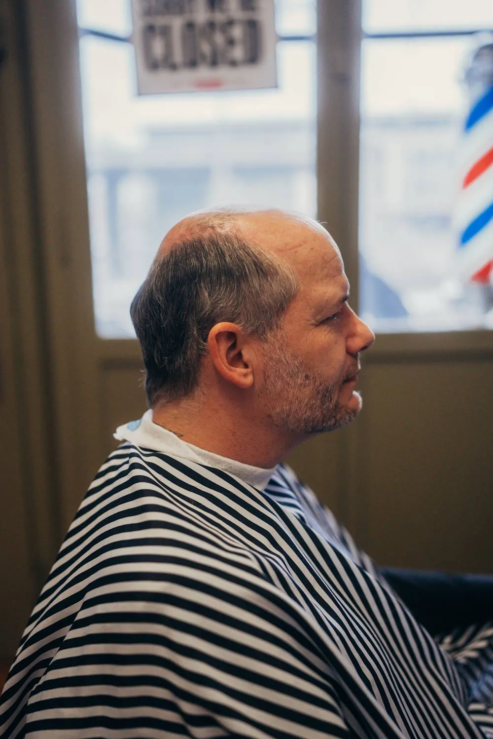 Markus vorher ohne Haarsystem