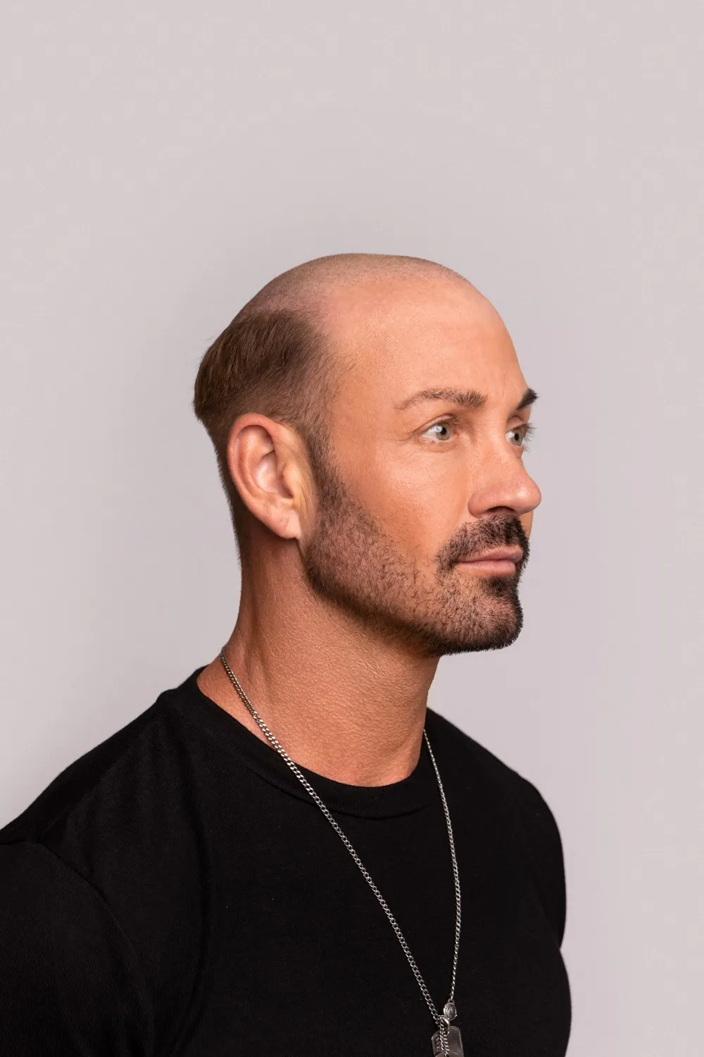 Torsten vorher im Profil